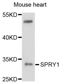 IHC-plus™ Polyclonal Rabbit anti-Human SPRY1 / Sprouty 1 Antibody (IHC, WB)