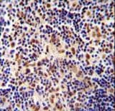 TIGD3 Antibody (aa378-407)