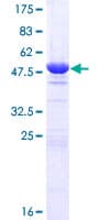 Human HEBP2 Protein (Recombinant GST)