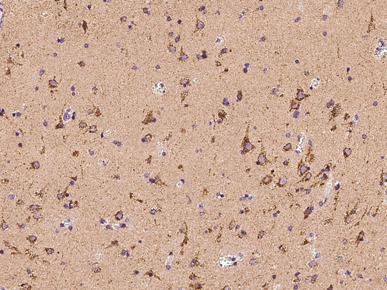 APLP1 / APLP-1 Antibody