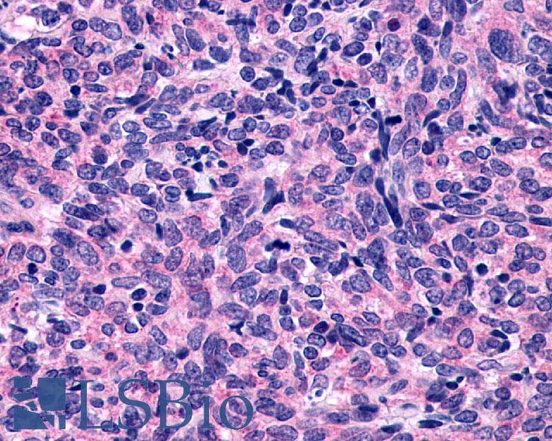 IHC-plus™ Polyclonal Rabbit anti-Human P2Y10 / P2RY10 Antibody (Extracellular Domain, IHC)