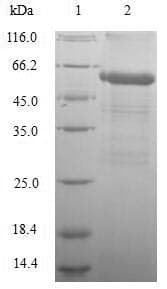Mouse GLP1R / GLP-1 Receptor Protein (Recombinant 6His-SUMO, N-terminus)