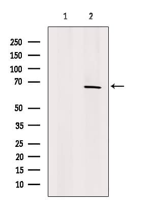 Polyclonal Rabbit anti-Human FAM13A1 / KIAA0914 Antibody (WB)