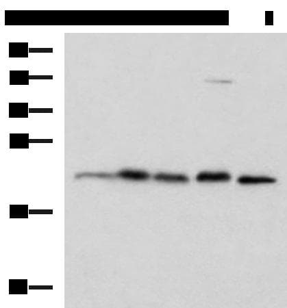 Polyclonal Rabbit anti-Human HPCAL1 / Hippocalcin-Like 1 Antibody (IHC, WB)