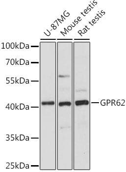 Polyclonal Rabbit anti-Human GPR62 Antibody (WB)