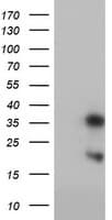 FXN / Frataxin Antibody (clone OTI1C12)