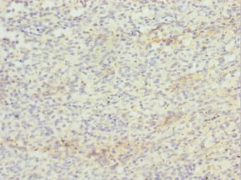 Polyclonal Rabbit anti-Human ZBTB48 / HKR3 Antibody (IHC)