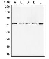 TP53 / p53 Antibody (N-Terminus)