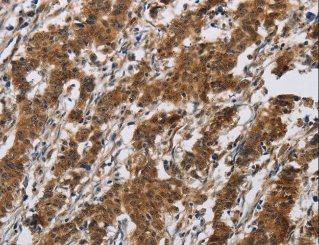 IHC-plus™ IL17RB Antibody