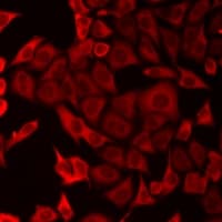 DOK4 Antibody