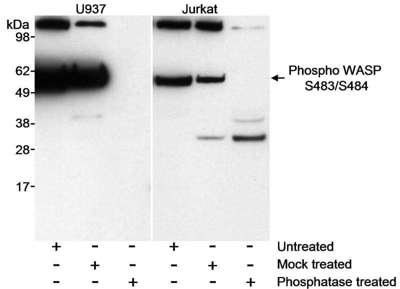 WAS / WASP Antibody (phospho-Ser483/484)