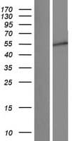 JMJD4 Protein (Over-Expression Lysate Myc-DDK (Flag))