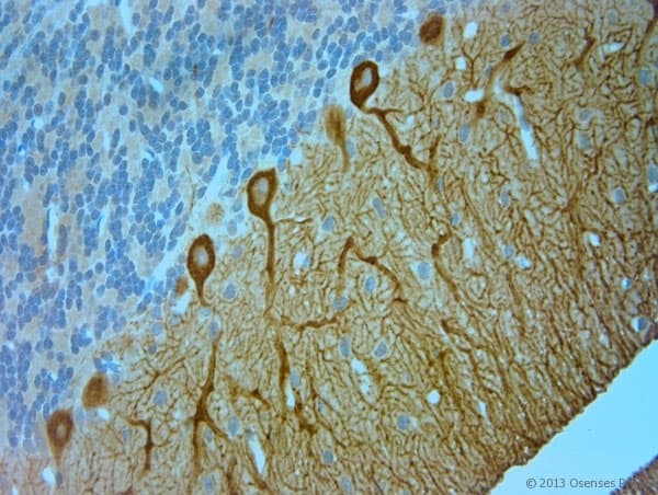 Polyclonal Rabbit anti-Human ITPR1 / IP3 Receptor Type 1 Antibody (aa700-750, IHC)