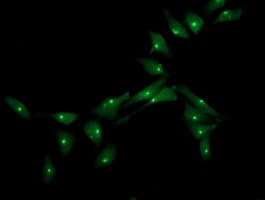 XPNPEP3 Antibody (clone OTI2D5)