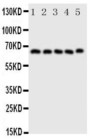 Polyclonal Rabbit anti-Human PTGS2 / COX2 / COX-2 Antibody (aa589-604, IHC, WB)