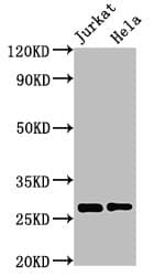HSD17B10 / HADH2 Antibody (aa2-261)
