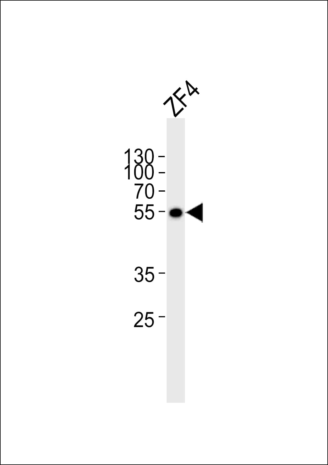 Polyclonal Rabbit anti-Zebrafish ANKRD13C Antibody (aa475-508, WB)