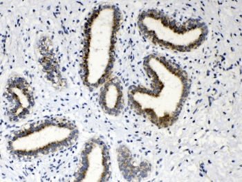 Polyclonal Rabbit anti-Human HSD17B4 Antibody (IHC, WB)