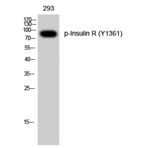 INSR / Insulin Receptor Antibody (1300-1380 aa)