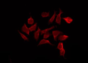 RPS6KA6 / RSK4 Antibody