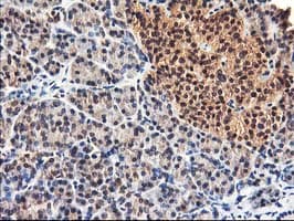 ALS2CR1 / NIF3L1 Antibody (clone OTI4B5)