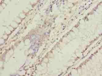 Polyclonal Rabbit anti-Human C11orf53 Antibody (IHC, WB)