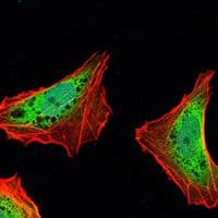 ATXN1 / SCA1 Antibody (clone 2F5)