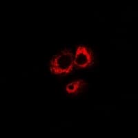 ABO Glycosyltransferase Antibody