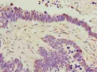 C6orf141 Antibody