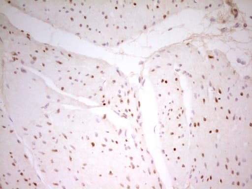 MEF2D Antibody (aa1-282, clone OTI3D12, Carrier-free)