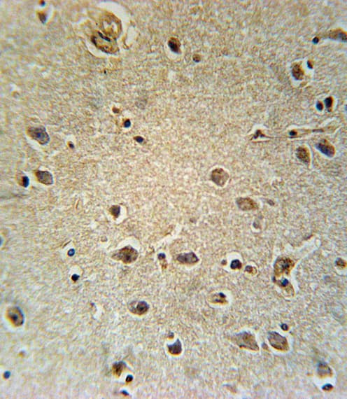 SLC25A1 / SEA Antibody (aa142-170)