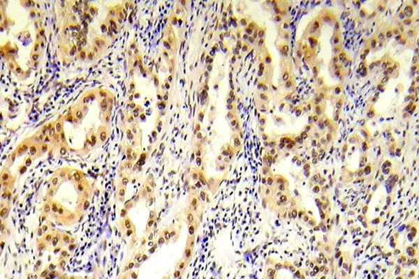 Tuberin / TSC2 Antibody (phospho-Ser1254)