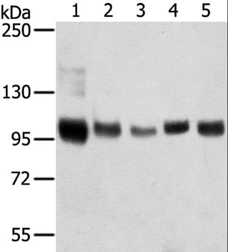 SORT1 / Sortilin Antibody