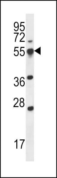 SMAP2 Antibody (aa111-140)