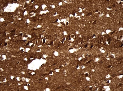 Monoclonal Mouse anti-Human UCHL1 / PGP9.5 Antibody (clone UMAB244, Carrier-free, IHC, WB)