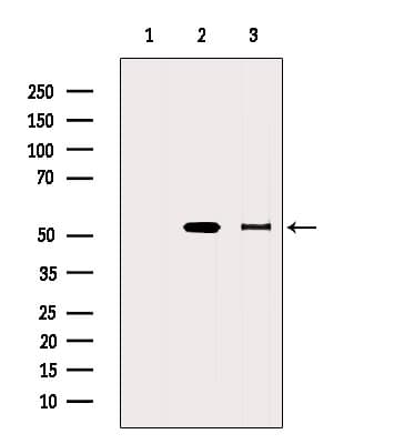 ALDH5A1 Antibody