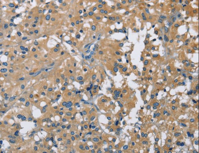 CAB39L Antibody