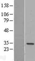 DPM1 Protein (Over-Expression Lysate Myc-DDK (Flag))