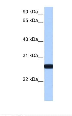 Polyclonal Rabbit anti-Human IL13RA2 / IL13R Alpha 2 Antibody (aa60-109, WB)