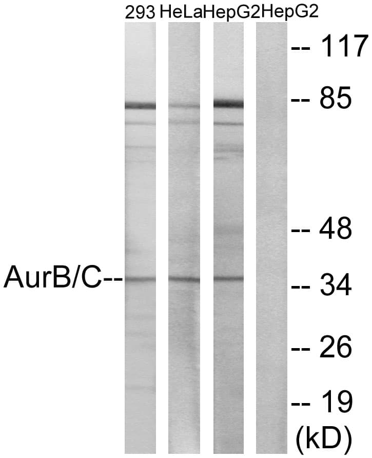 Polyclonal Rabbit anti-Human Aurora Kinase B+C Antibody (Internal, WB)