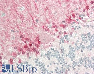 IHC-plus™ KPI-2 / LMTK2 Antibody (aa636-685)