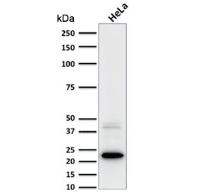 FTL / Ferritin Light Chain Antibody (clone FTL/1387)