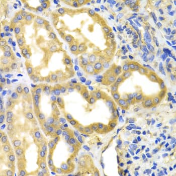 DPYD / DPD Antibody
