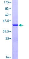 Human NHP2L1 Protein (Recombinant GST)
