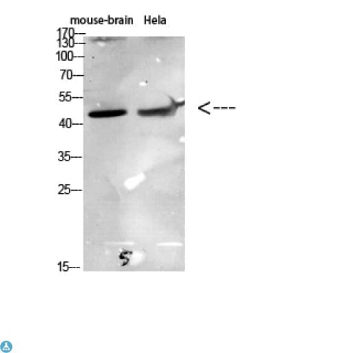 CCR6 Antibody
