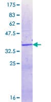 Human XRN2 Protein (Recombinant GST, N-terminus)