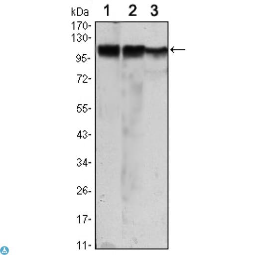 HK2 / Hexokinase 2 Antibody