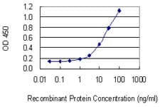 TNR / Tenascin R Antibody (clone 1D12)