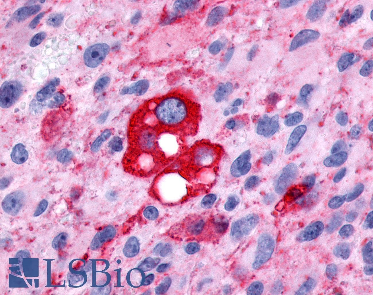 PathPlus™ FP / PTGFR Antibody (Extracellular Domain)
