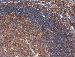 Monoclonal Mouse anti-Human CTAG1B / NY-ESO-1 Antibody (clone OTI5H4, IHC, IF, WB)